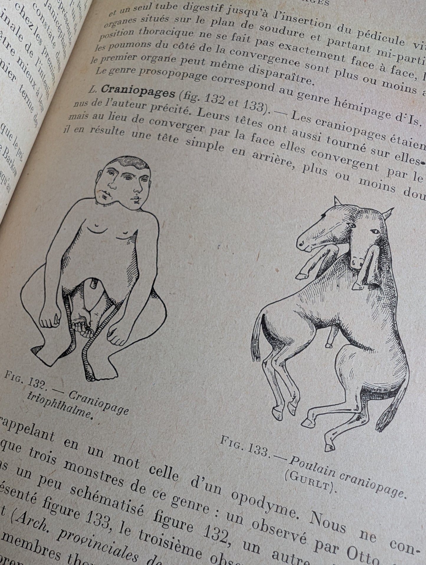Livre 1927 Traité de Tératologie (252 figures de monstres et malformations)