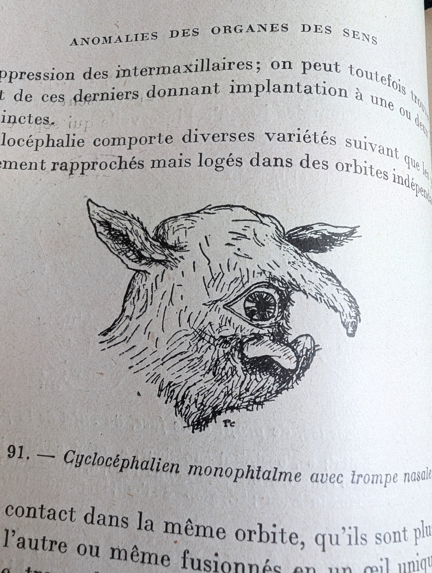 Livre 1927 Traité de Tératologie (252 figures de monstres et malformations)