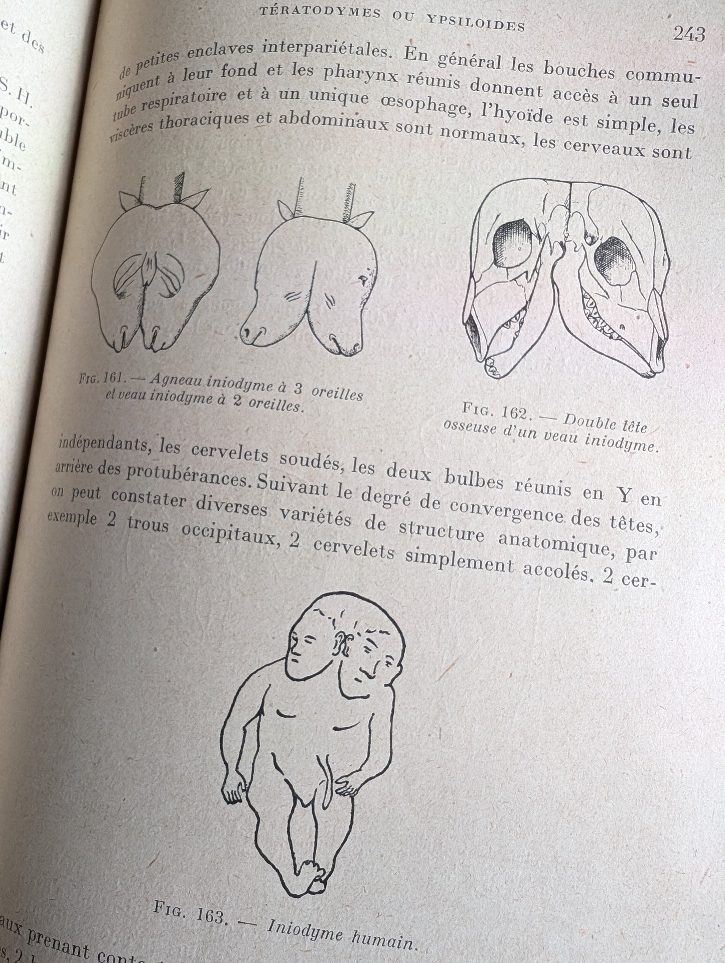 Livre 1927 Traité de Tératologie (252 figures de monstres et malformations)