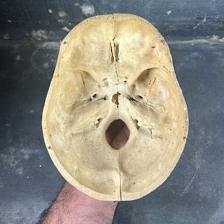 Beautiful medicalized Male Skull with complete teeth