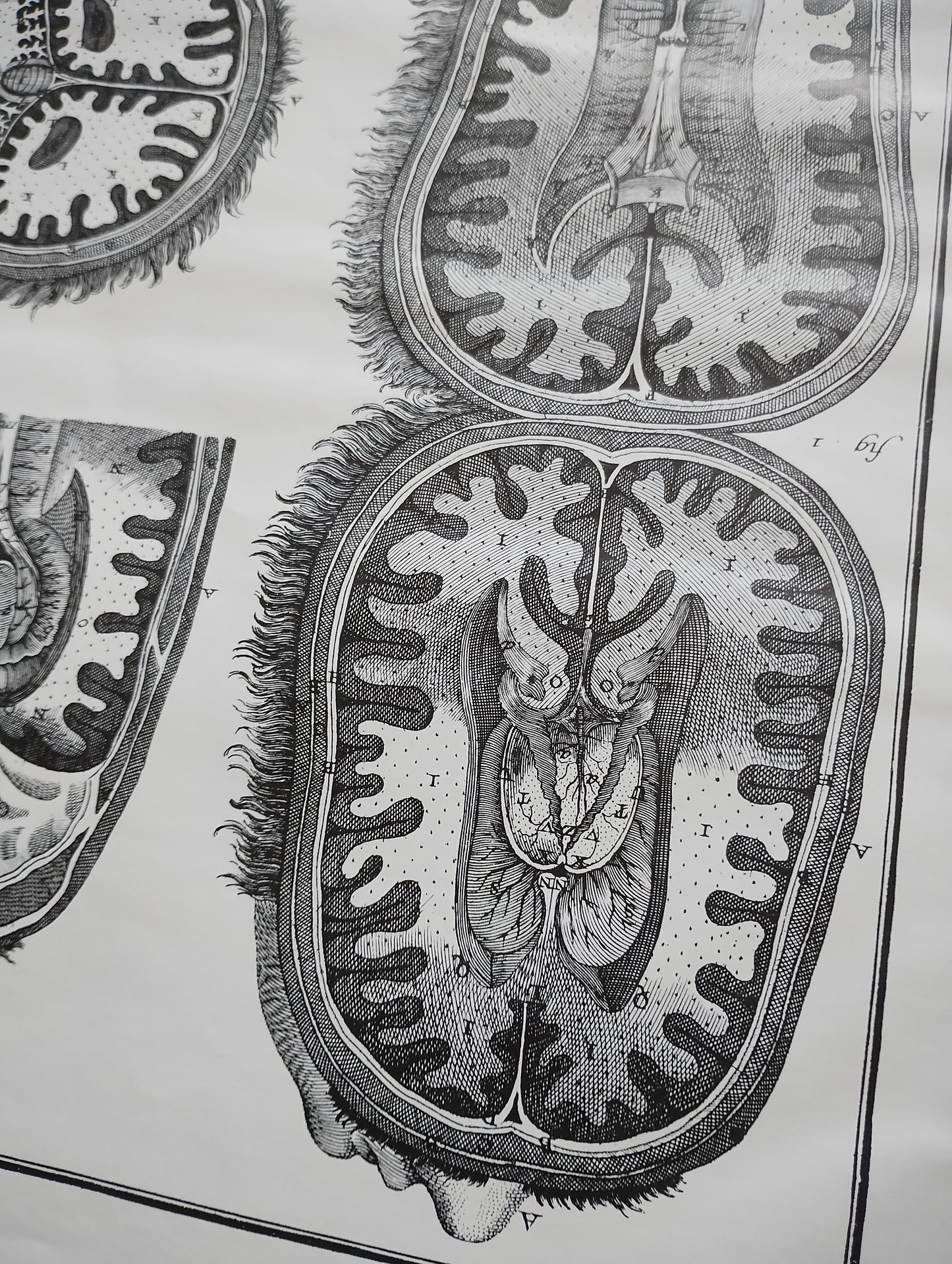 Old 19th anatomy lithograph set #6