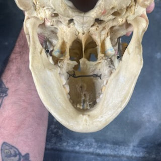 Beautiful medicalized Male Skull with complete teeth