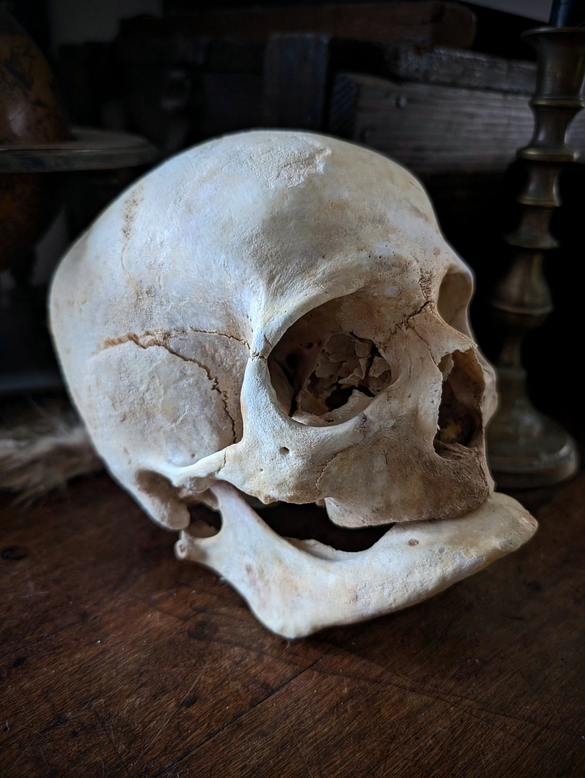 Ancient geriatric male skull (late 19th century, Italy)