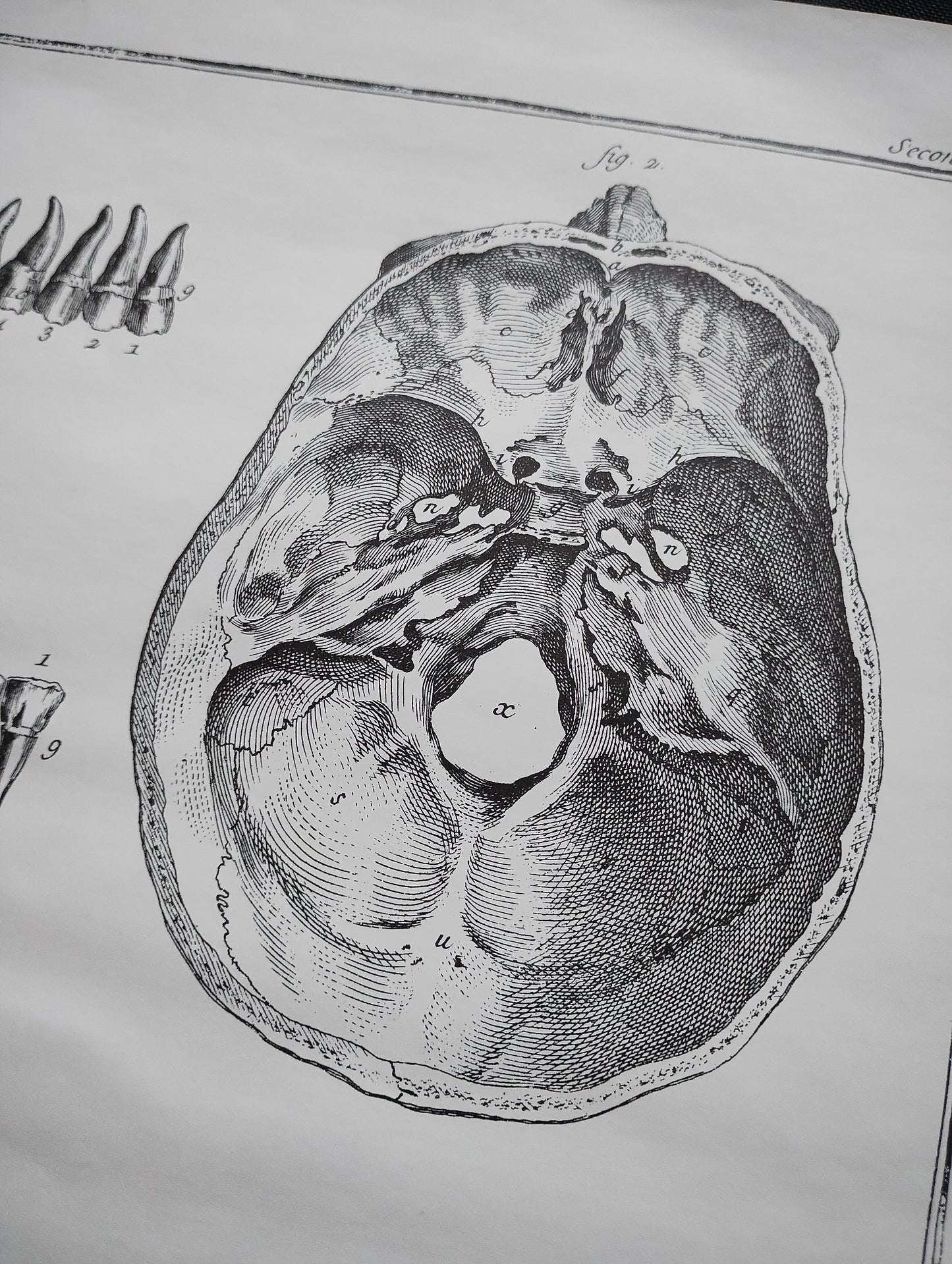 Old 19th anatomy lithograph set #6