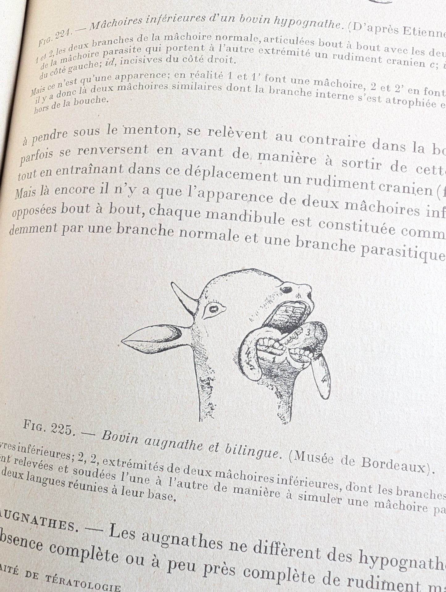 Livre 1927 Traité de Tératologie (252 figures de monstres et malformations)