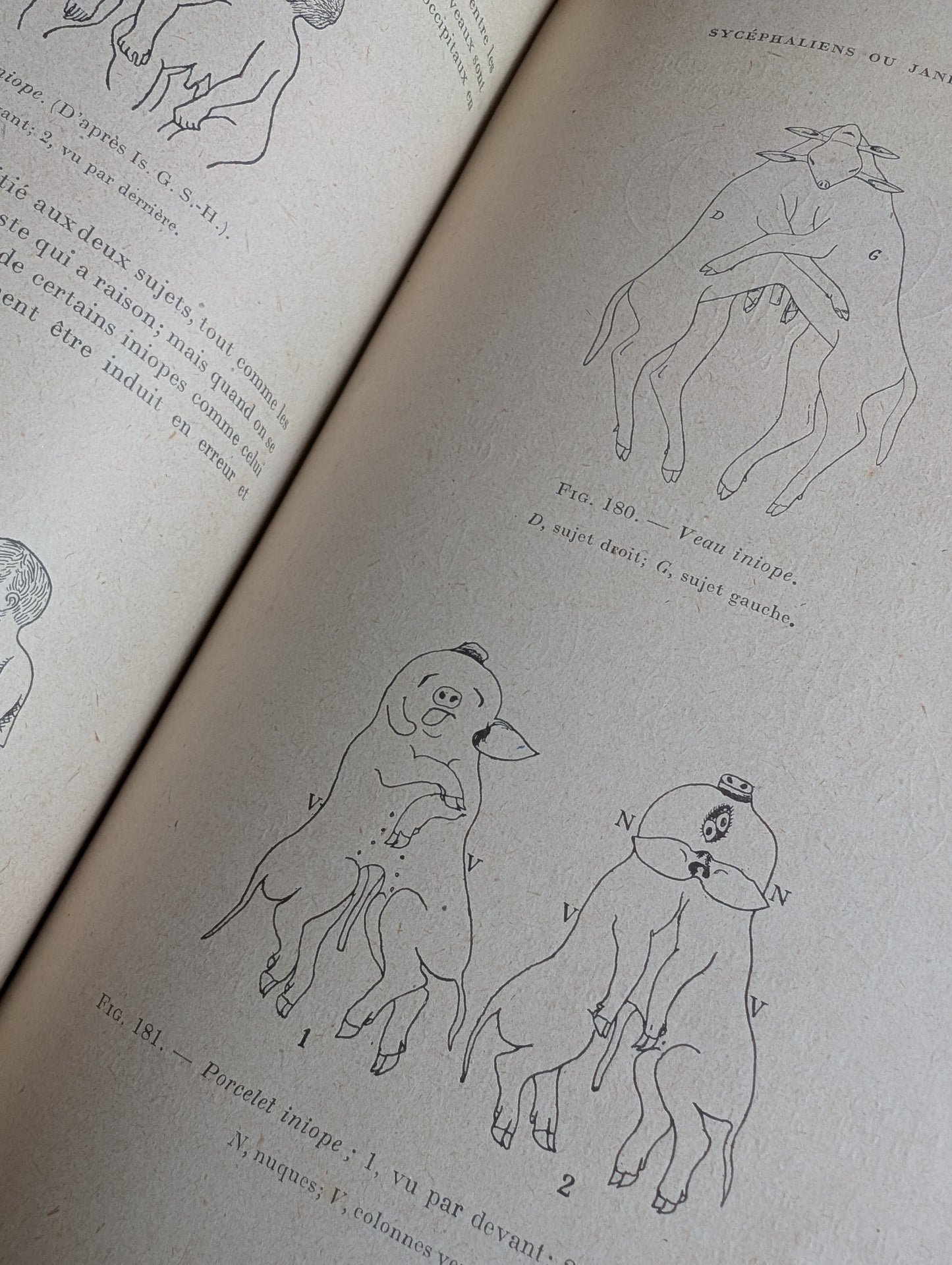 Livre 1927 Traité de Tératologie (252 figures de monstres et malformations)
