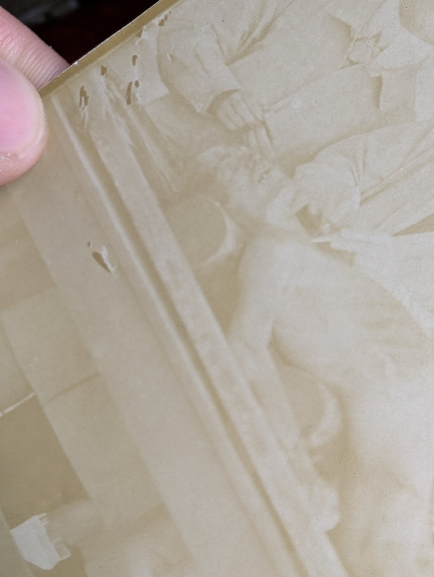 Old Autopsy photo early 1910's #2