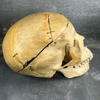 Beautiful medicalized Male Skull with complete teeth