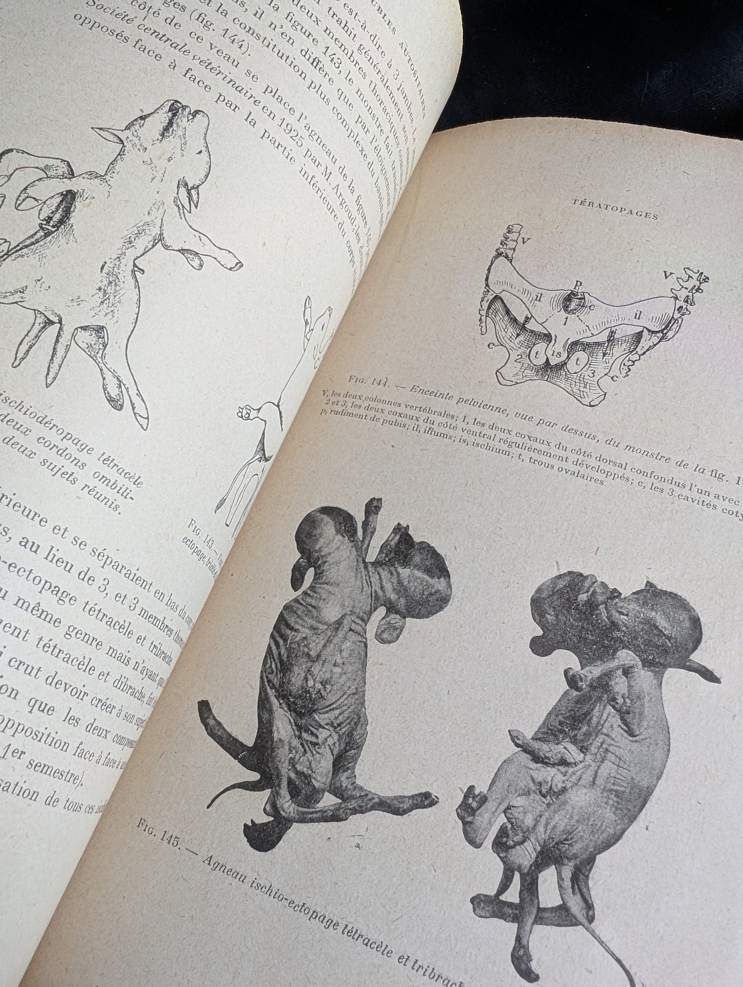Livre 1927 Traité de Tératologie (252 figures de monstres et malformations)