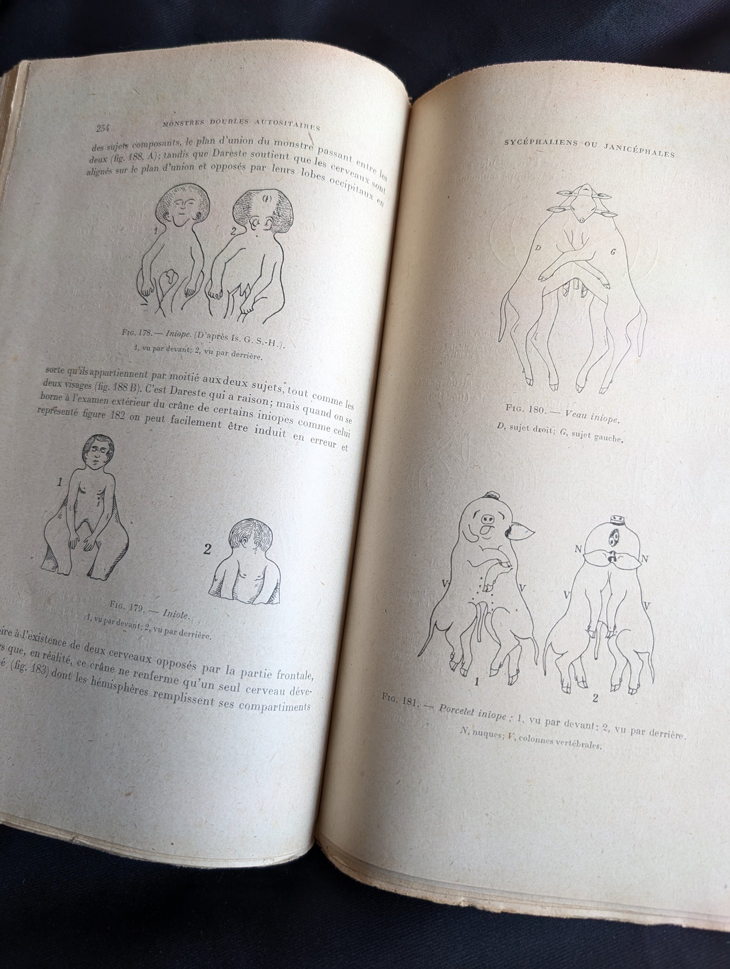 Livre 1927 Traité de Tératologie (252 figures de monstres et malformations)