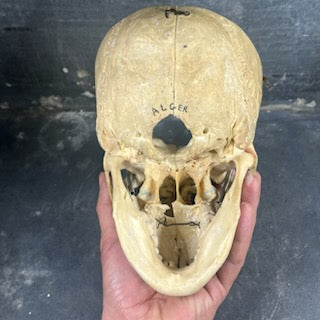 Beautiful medicalized Male Skull with complete teeth