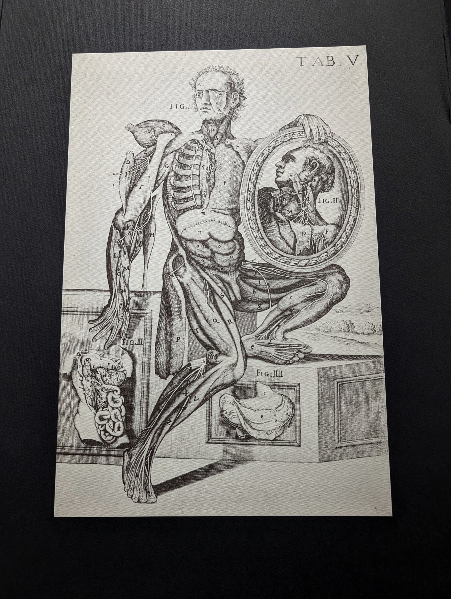 "Médecine d'Autrefois" with twelve prints in facsimile on black paper, size 51x31cm, edition from 1985