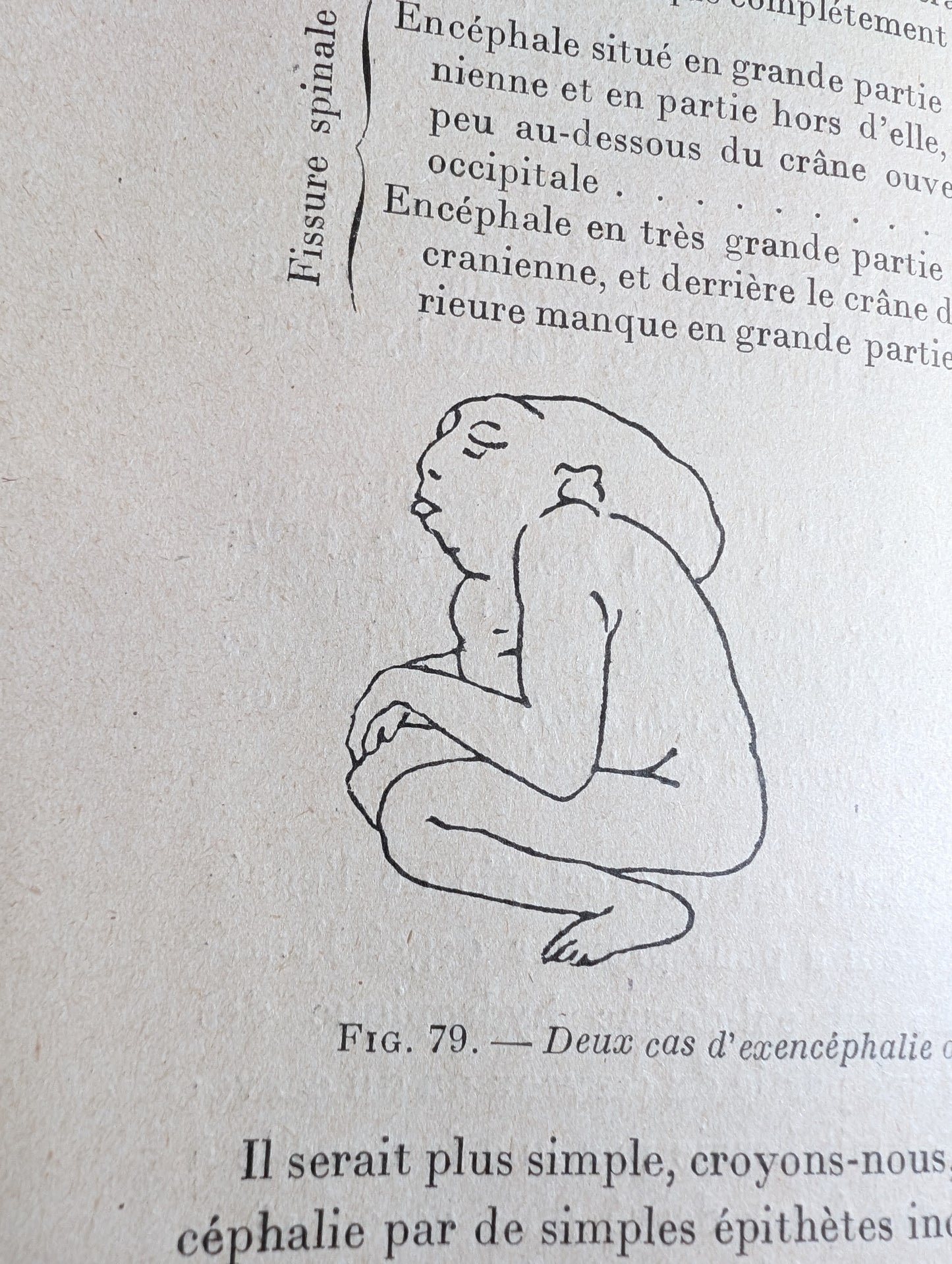 Livre 1927 Traité de Tératologie (252 figures de monstres et malformations)