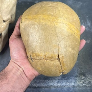 Beautiful medicalized Male Skull with complete teeth