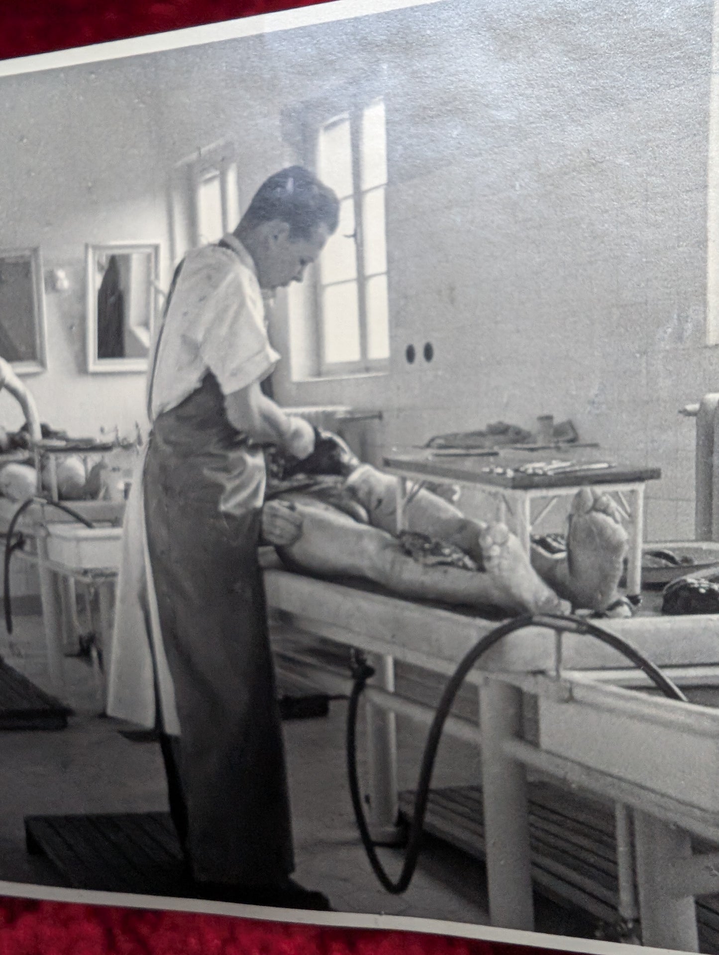 Old autopsy photo early 20th century