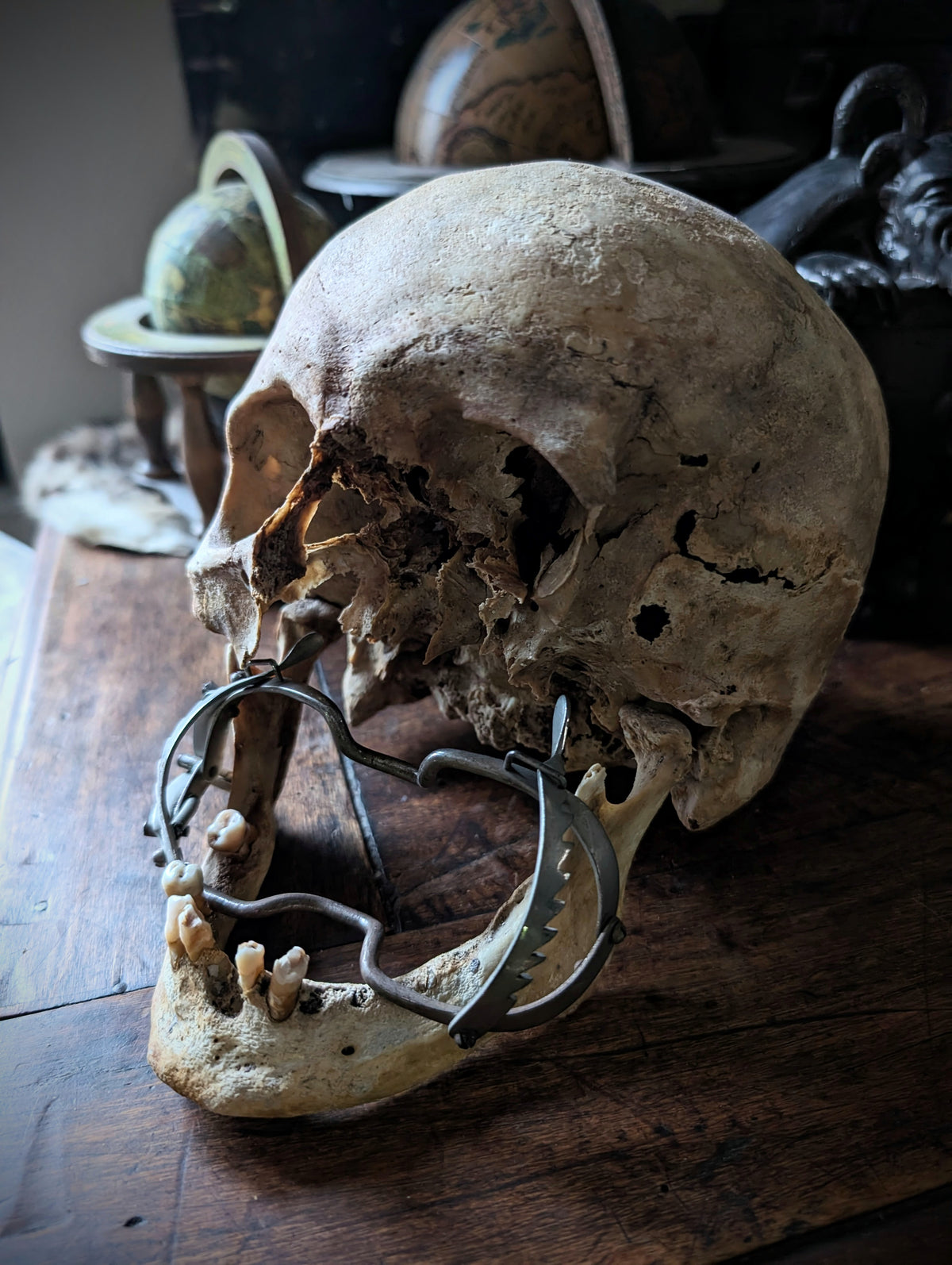 Antique Male Skull with Vintage Medical Mouth Opener – Anatomical Curiosity, early 20th century from Germany