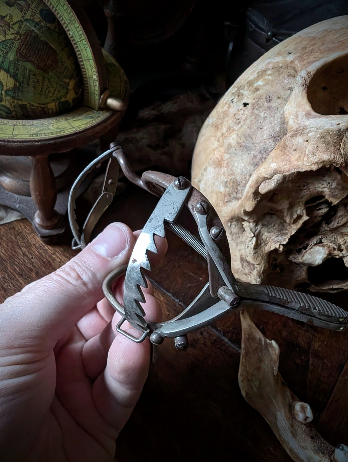 Antique Male Skull with Vintage Medical Mouth Opener – Anatomical Curiosity, early 20th century from Germany