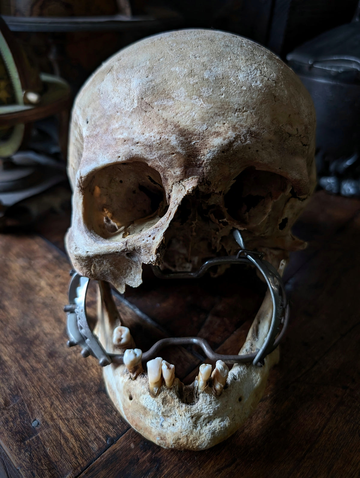 Antique Male Skull with Vintage Medical Mouth Opener – Anatomical Curiosity, early 20th century from Germany