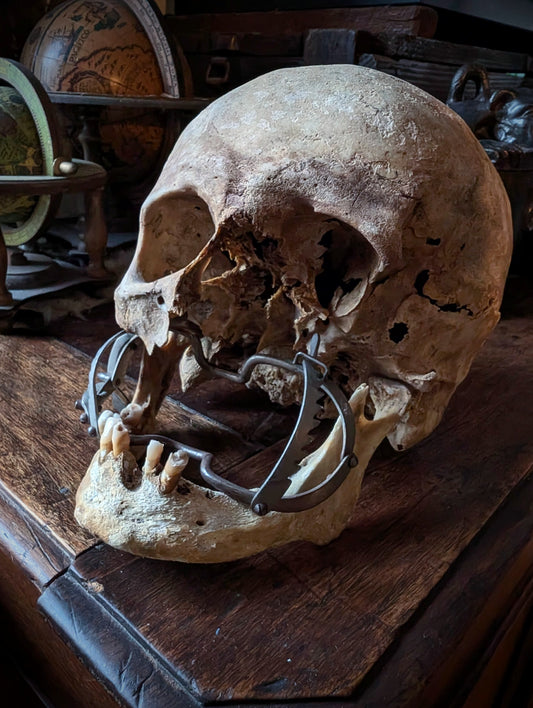 Antique Male Skull with Vintage Medical Mouth Opener – Anatomical Curiosity, early 20th century from Germany