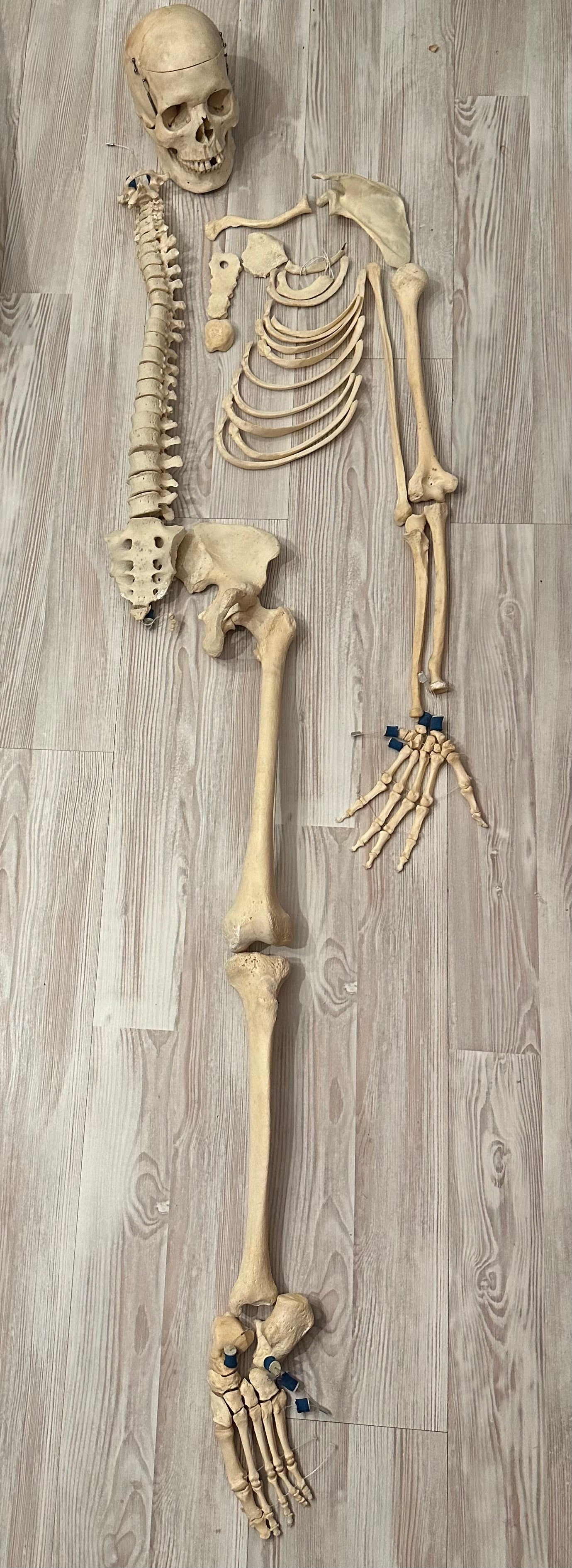 Medicalized Half-skeleton in case