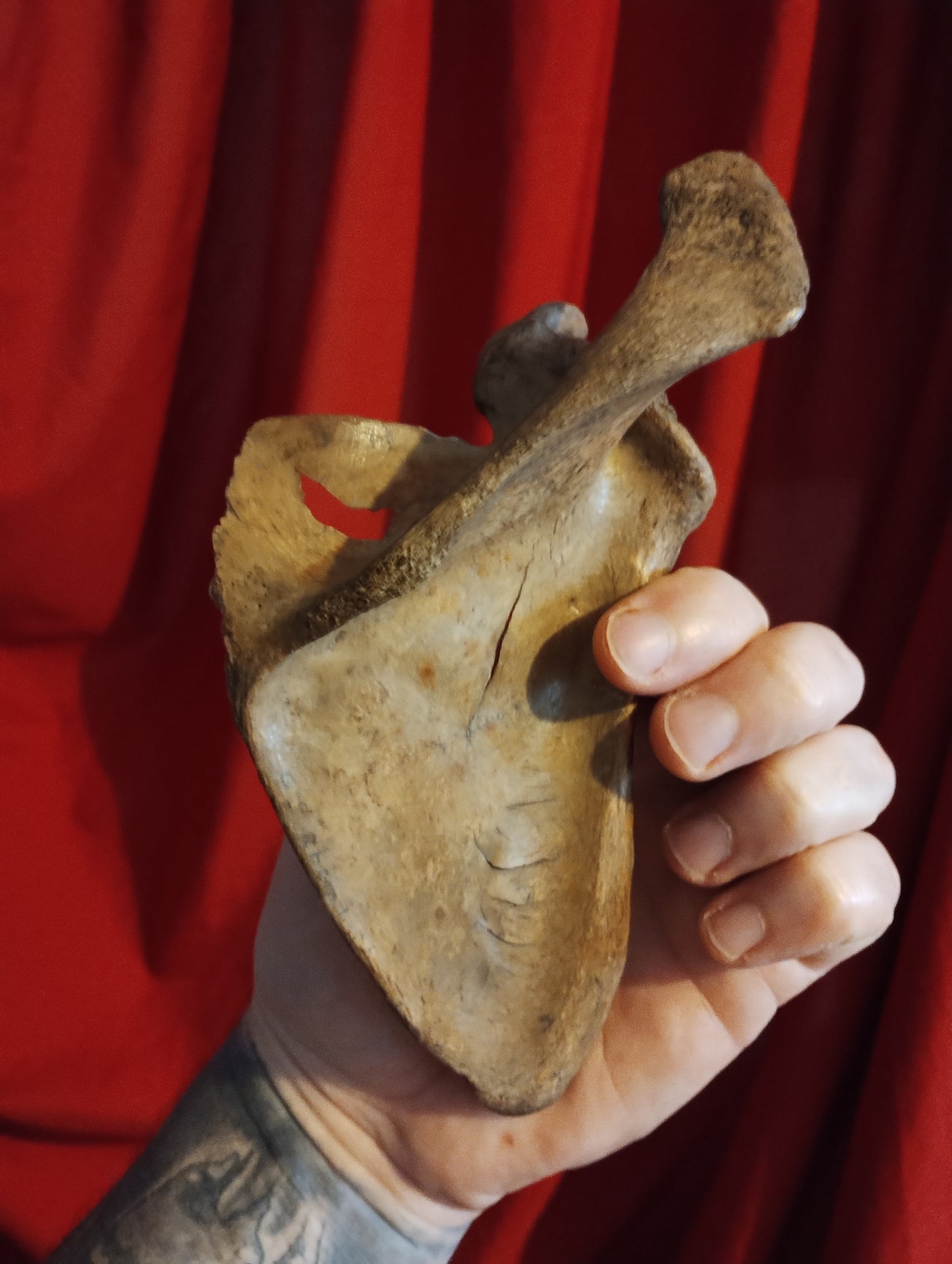 Old medicalised human scapula Dark patina