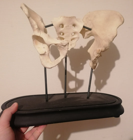 Antique medicalised human hips and sacrum on base