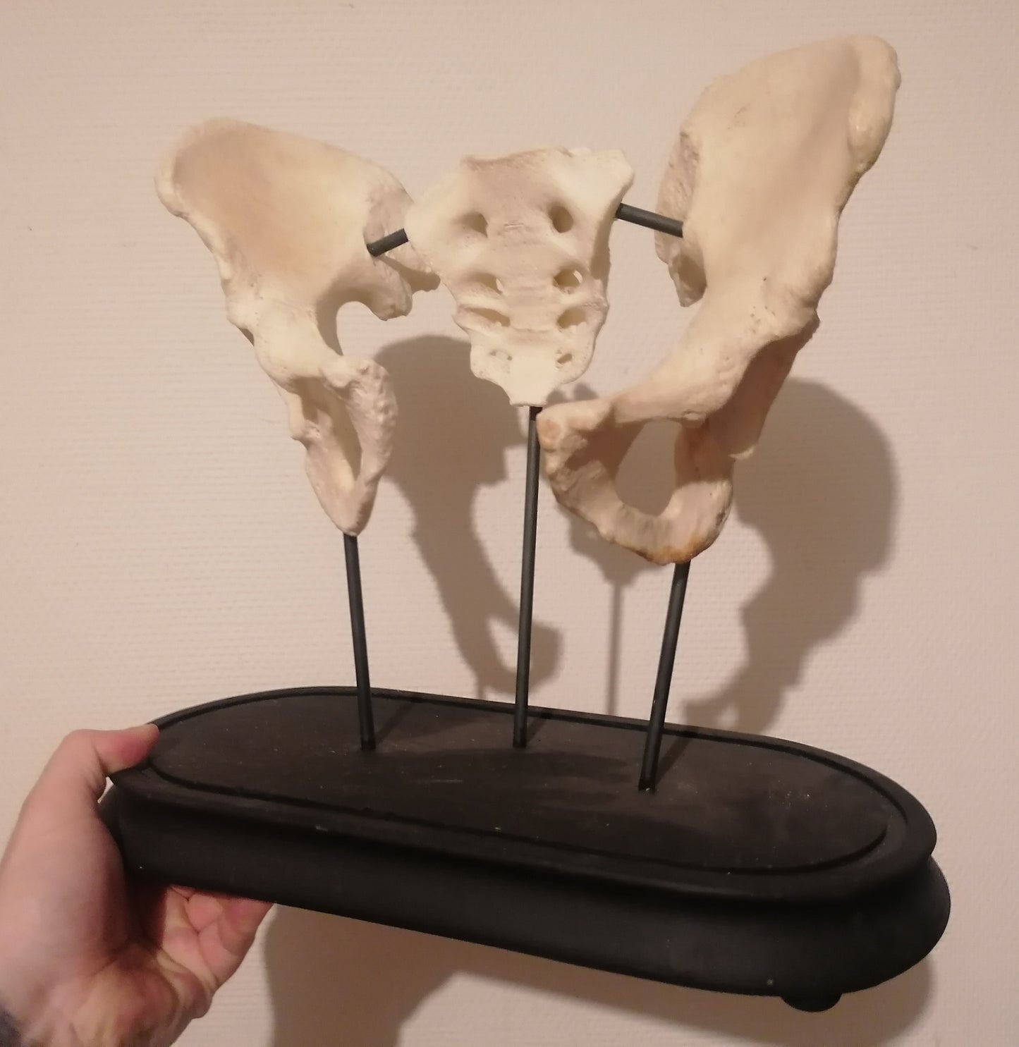 Antique medicalised human hips and sacrum on base