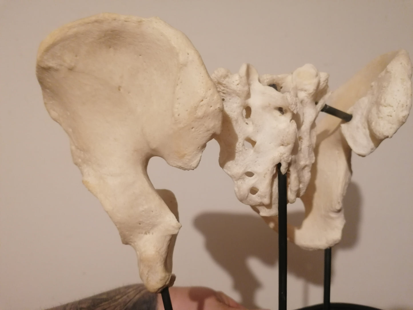 Antique medicalised human hips and sacrum on base