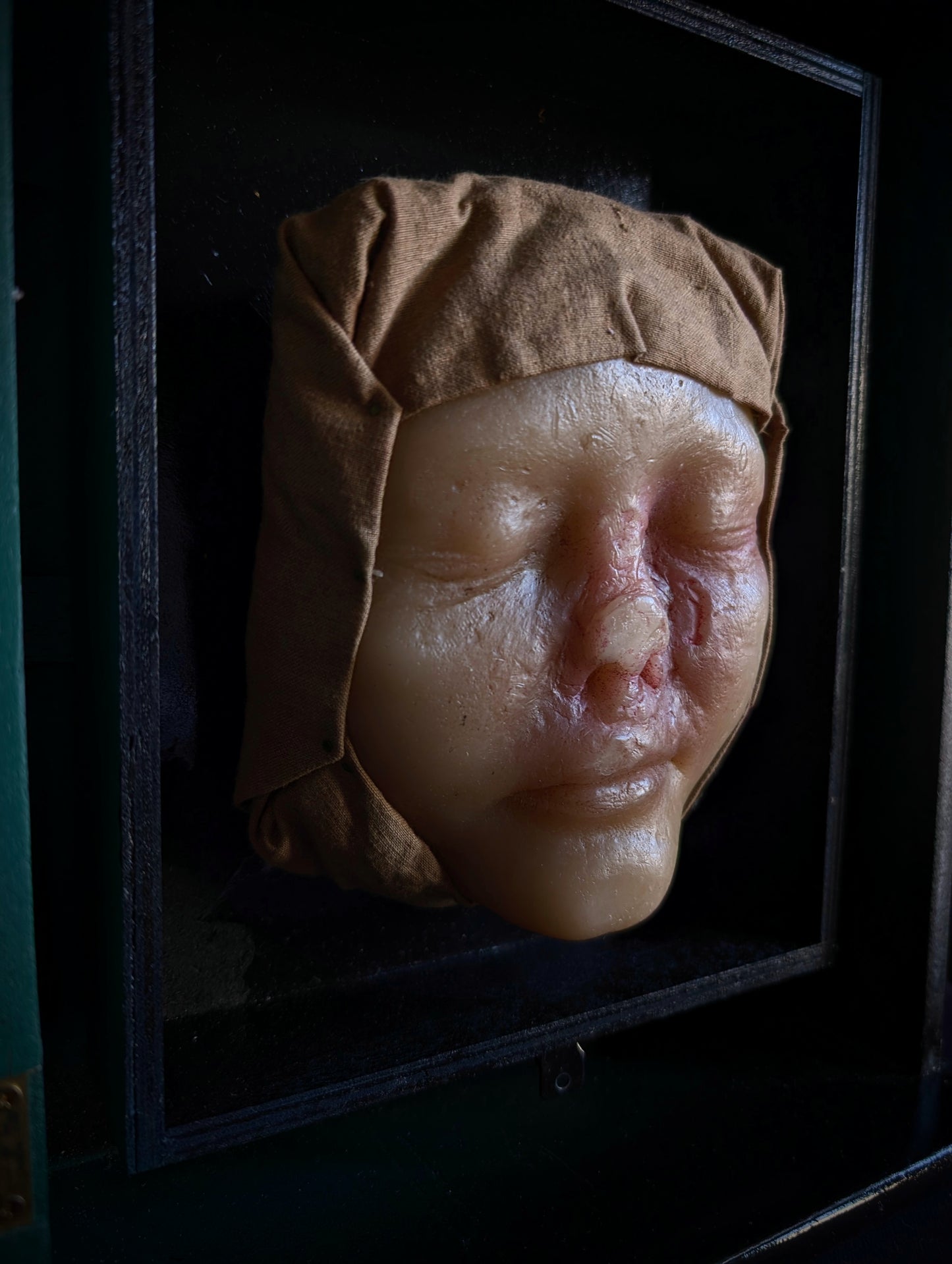 Vintage Medical Wax Moulage – Post-Mortem Study of a Woman Following Nasal Necrosis (Post Mortem)
