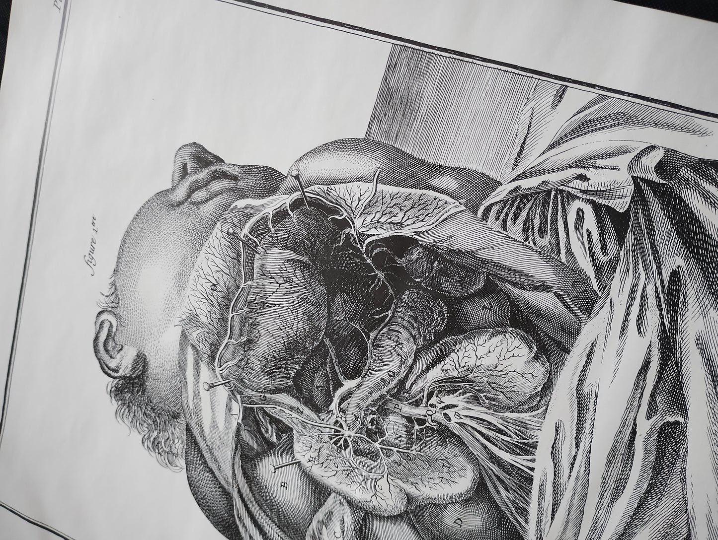 Old 19th anatomy lithograph set #1