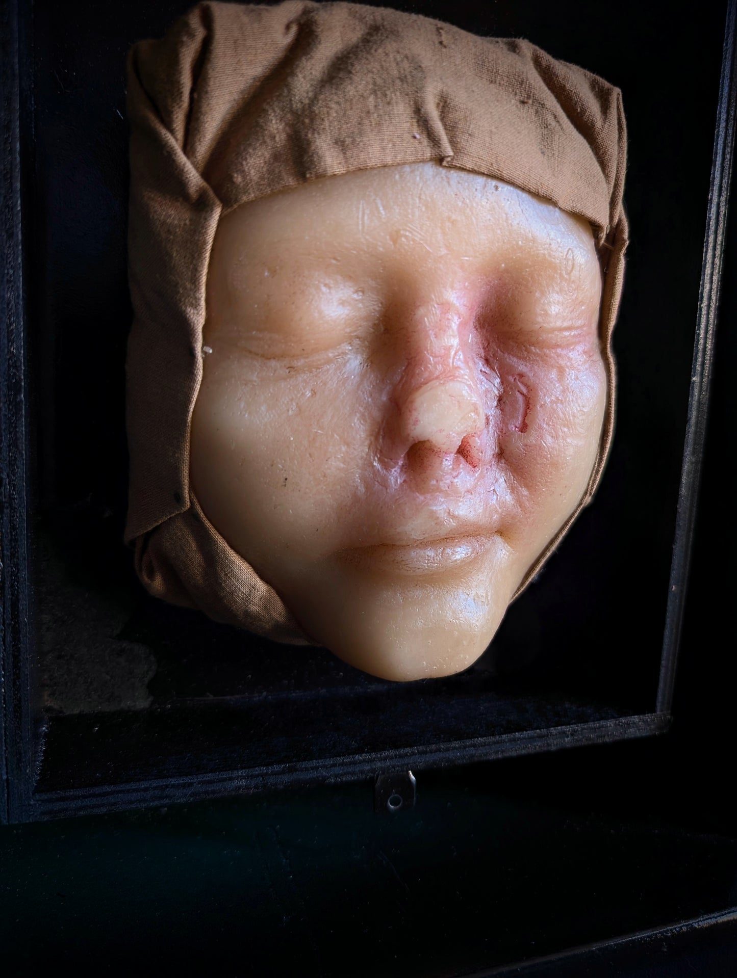 Vintage Medical Wax Moulage – Post-Mortem Study of a Woman Following Nasal Necrosis (Post Mortem)