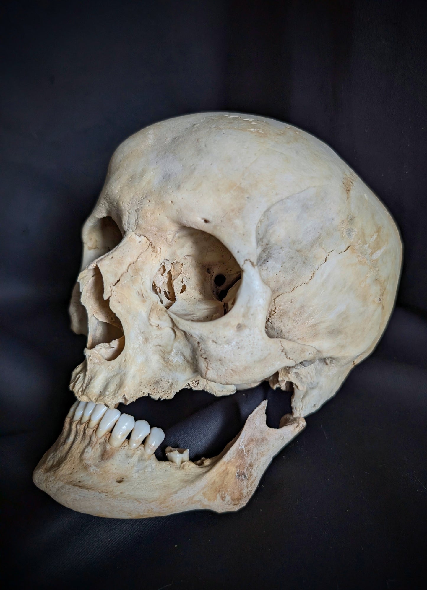 An antique German skull from the late 19th century