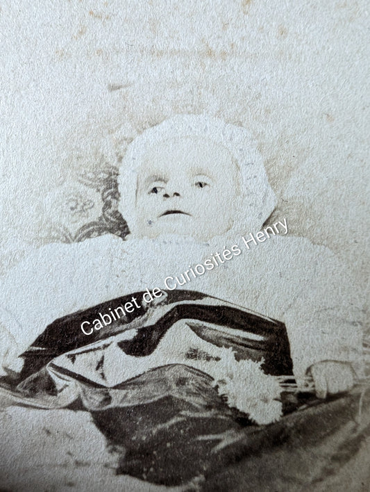 Old post-mortem photography of a child late 19th