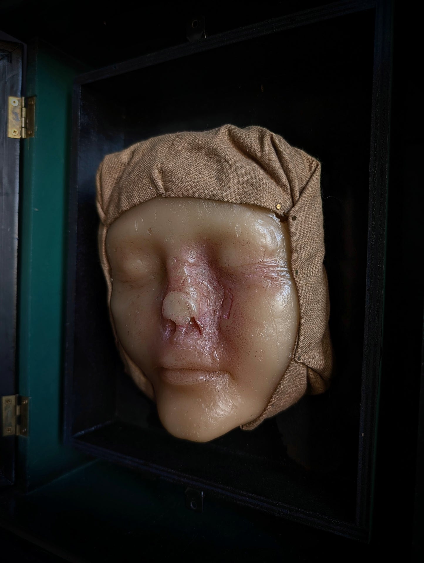 Vintage Medical Wax Moulage – Post-Mortem Study of a Woman Following Nasal Necrosis (Post Mortem)