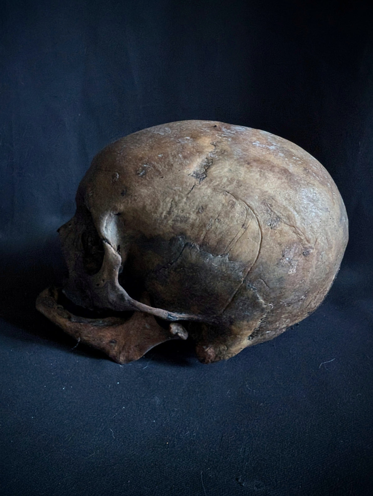 Antique Woman Skull with dark patina – Unusual Cranial Shape (Mid-19th Century, Italy)