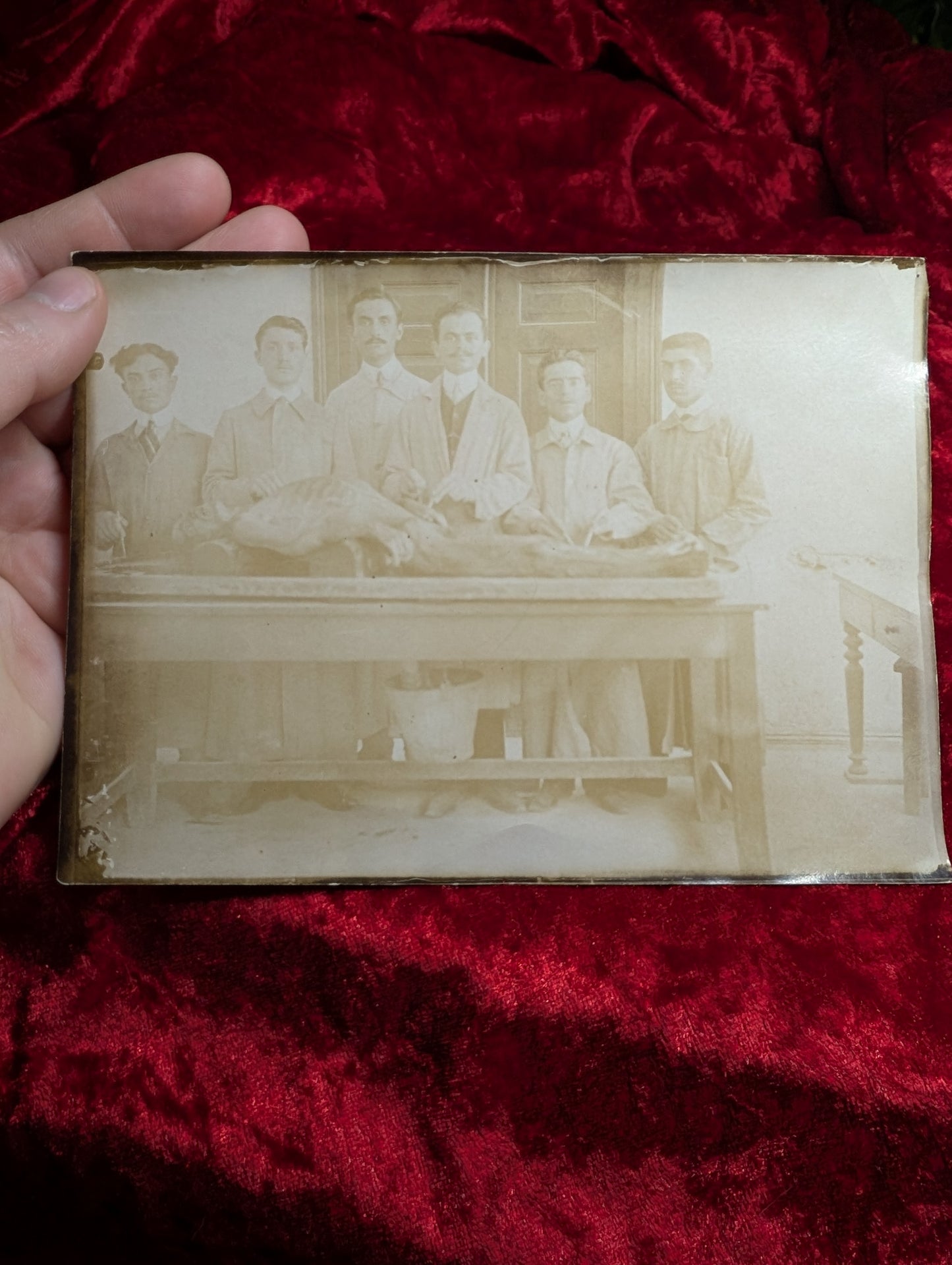 Old Autopsy photo early 1910's