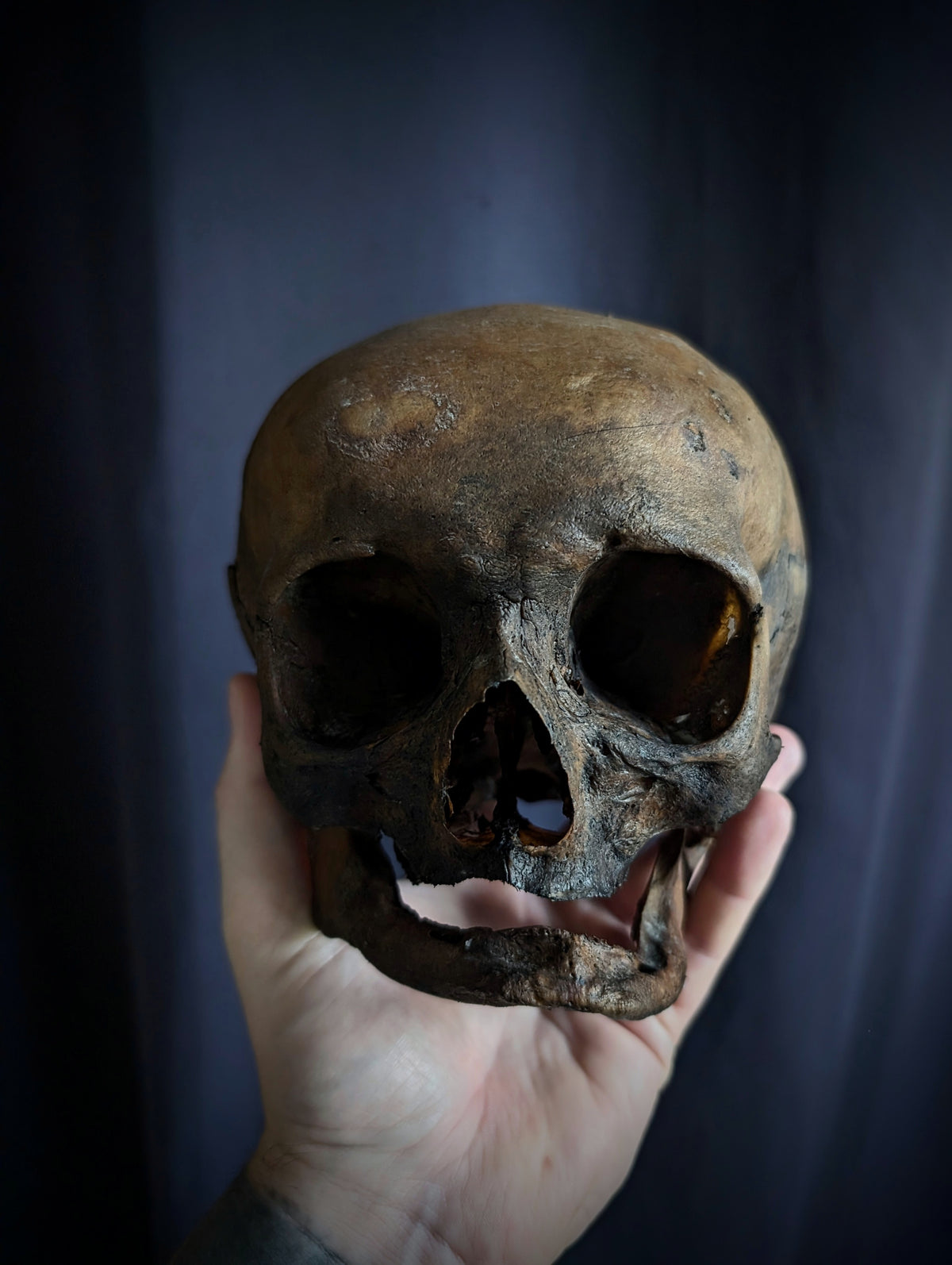 Antique Woman Skull with dark patina – Unusual Cranial Shape (Mid-19th Century, Italy)