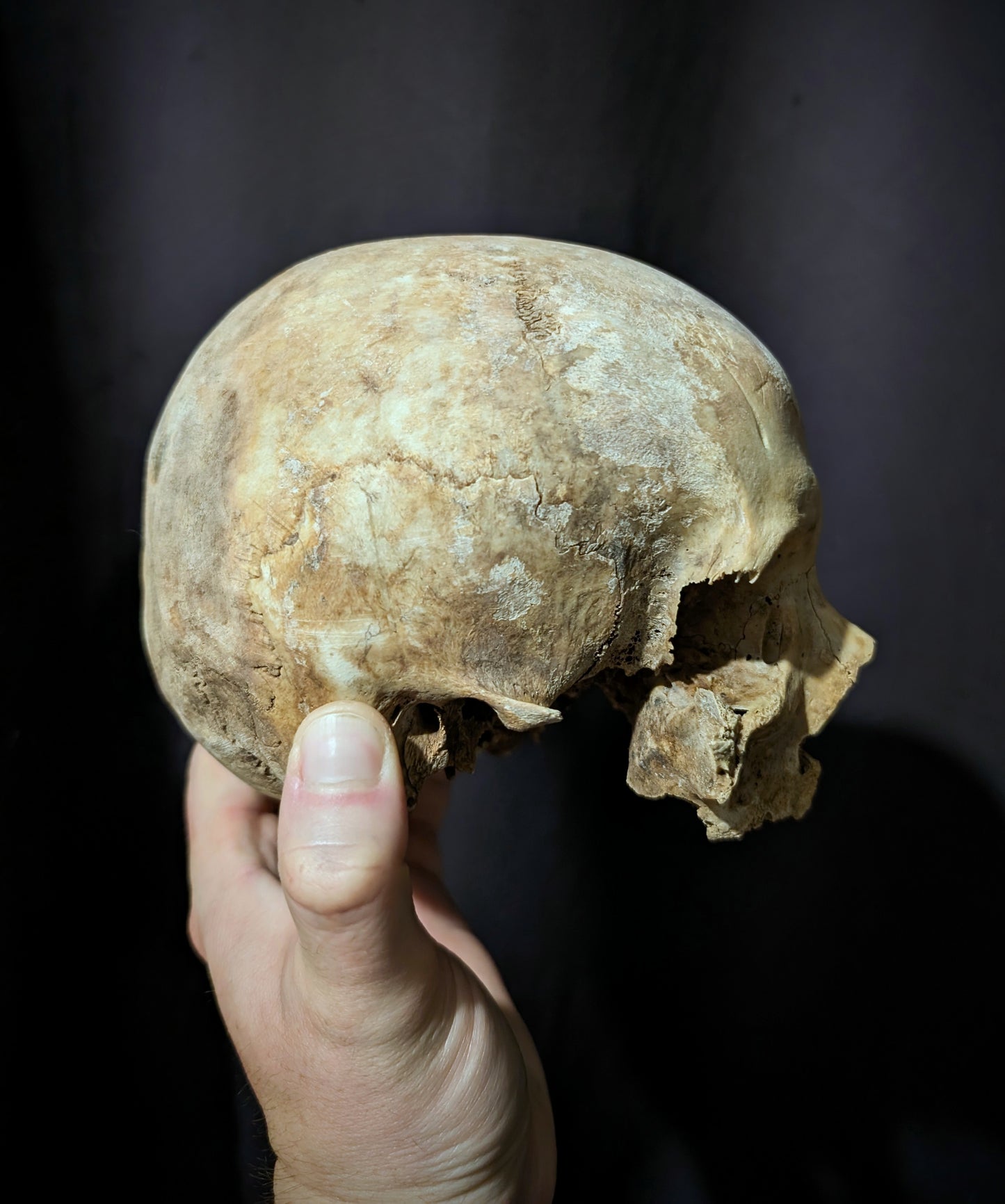 Old skull from late 19th century (Germany)