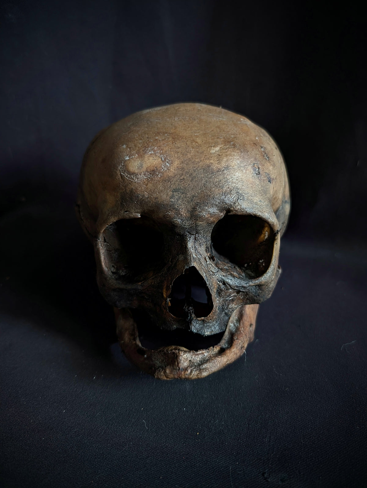 Antique Woman Skull with dark patina – Unusual Cranial Shape (Mid-19th Century, Italy)