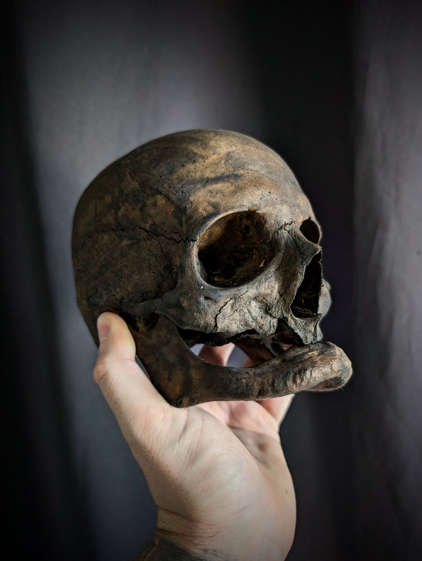Antique dark geriatric skull from late 19th century
