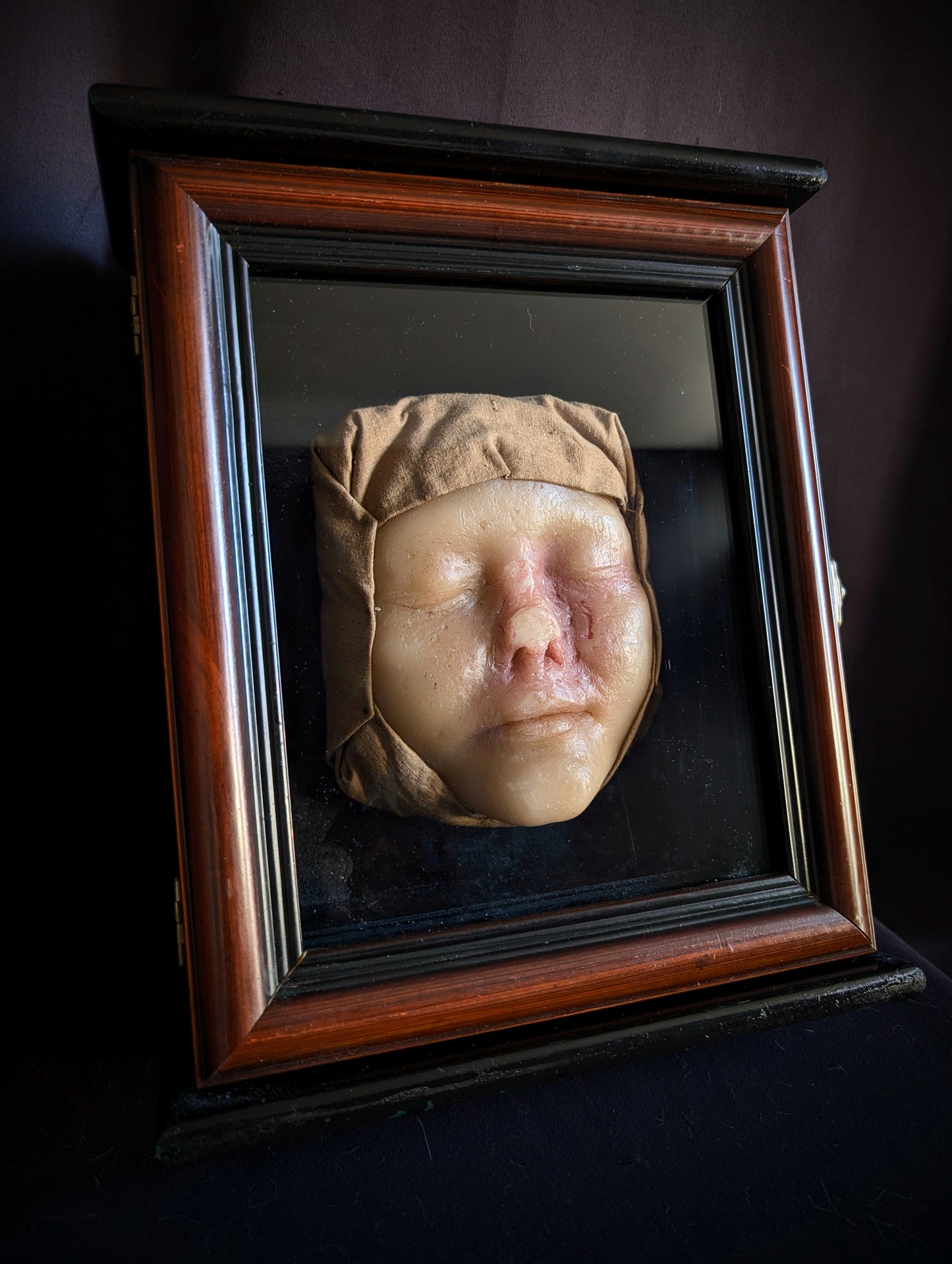 Vintage Medical Wax Moulage – Post-Mortem Study of a Woman Following Nasal Necrosis (Post Mortem)