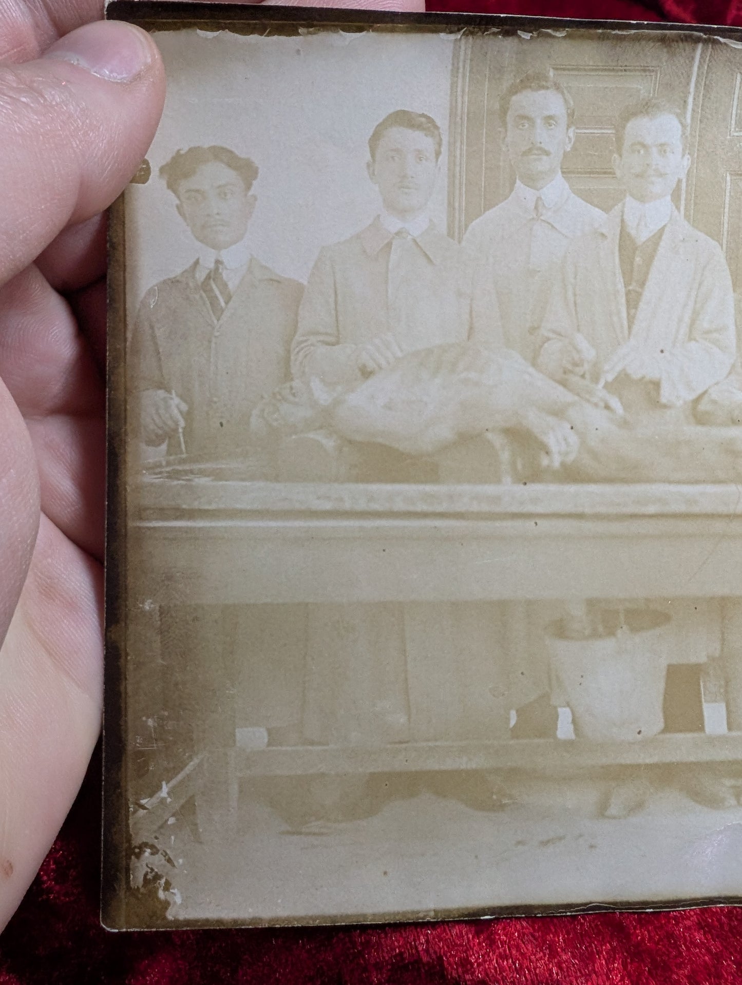 Old Autopsy photo early 1910's