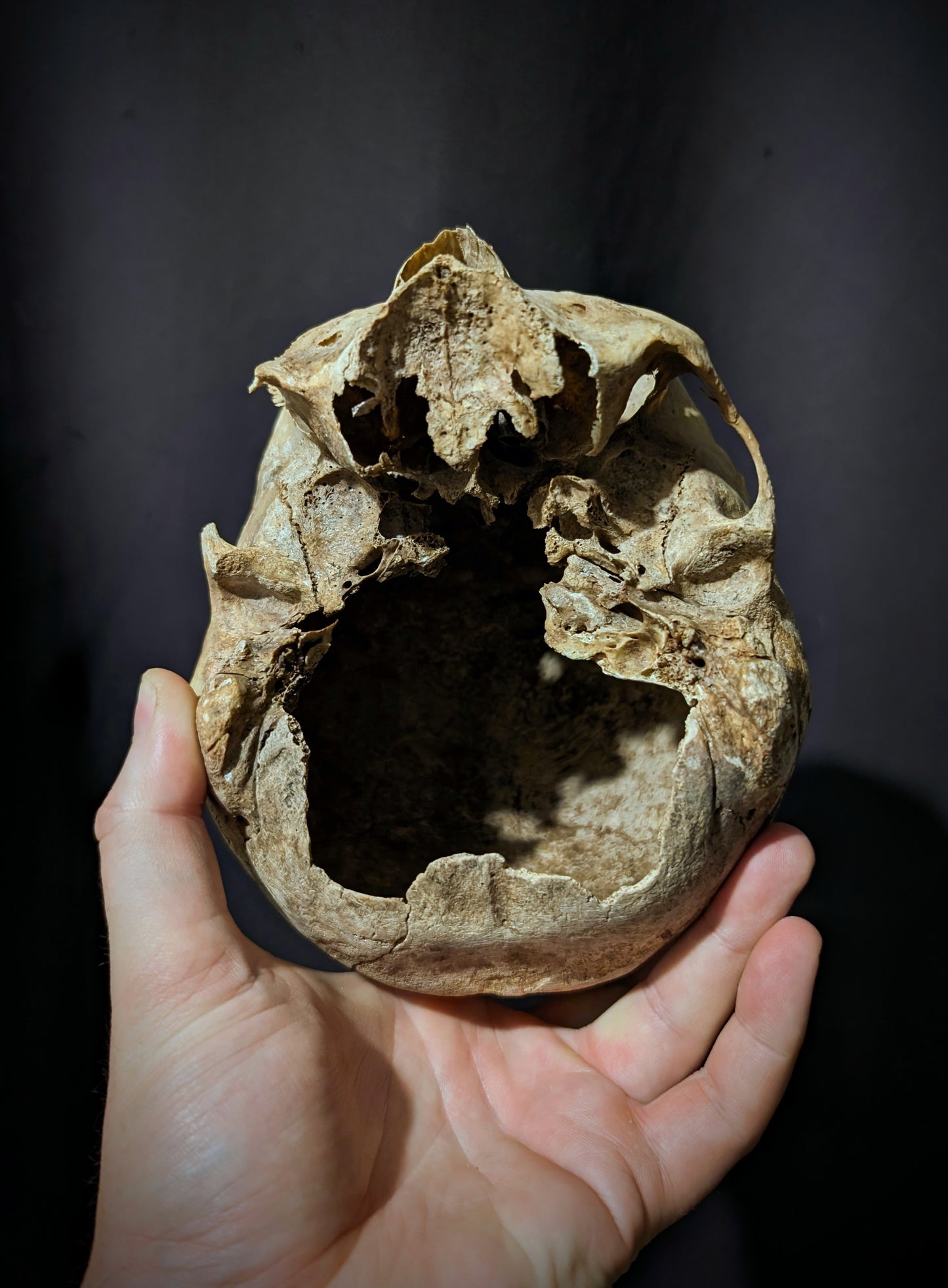 Old skull from late 19th century (Germany)