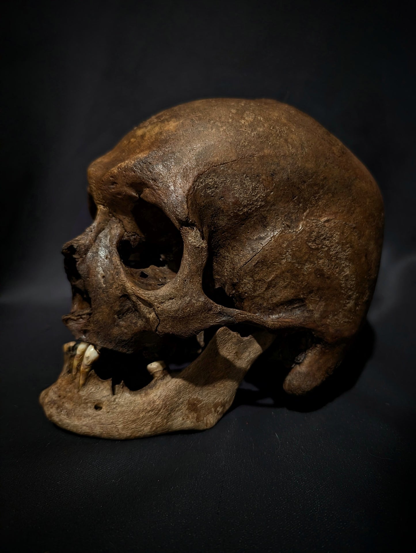 A beautiful antique skull from the 19th century with a dark patina (from a private collection in Italy)