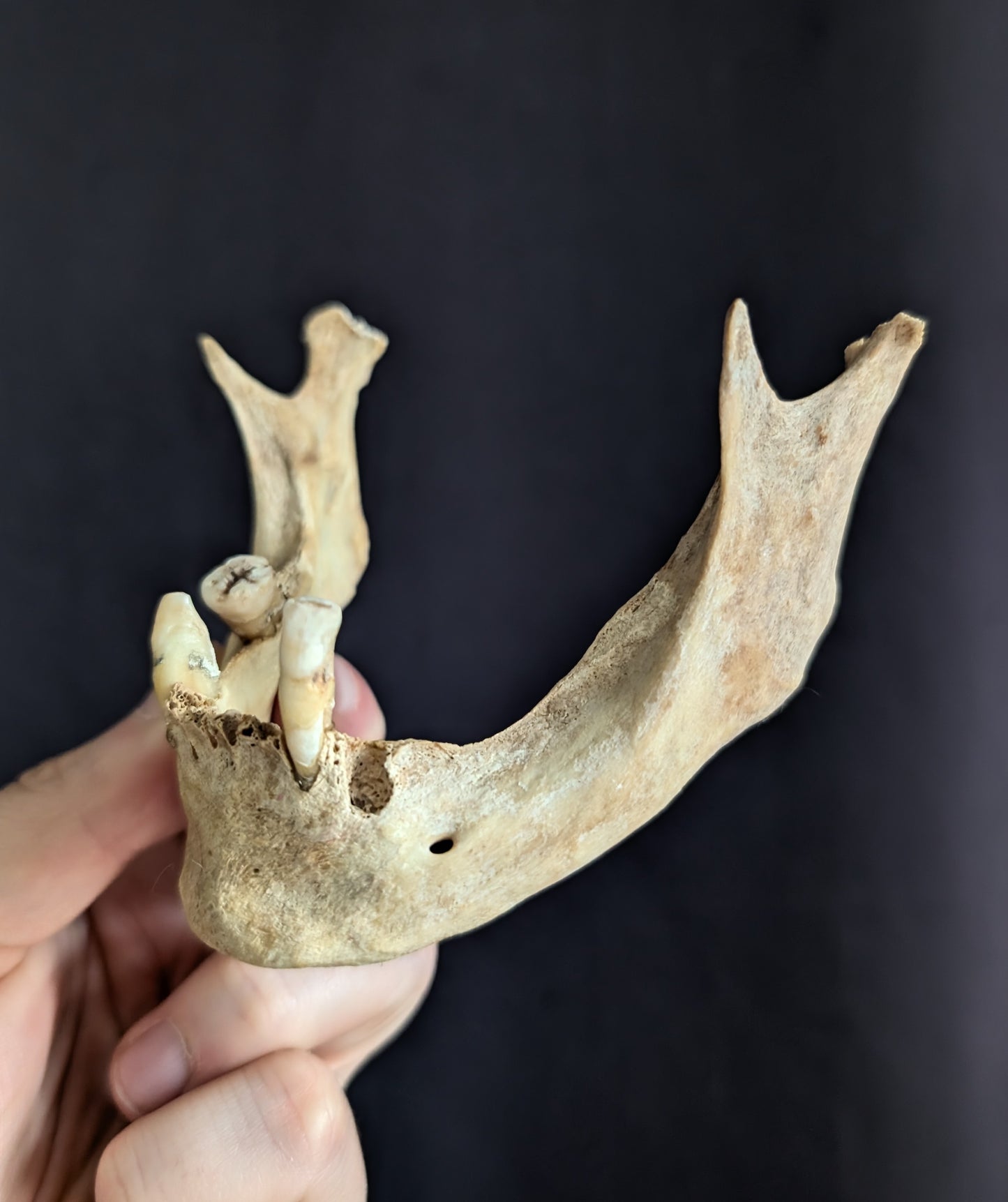 Old mandible