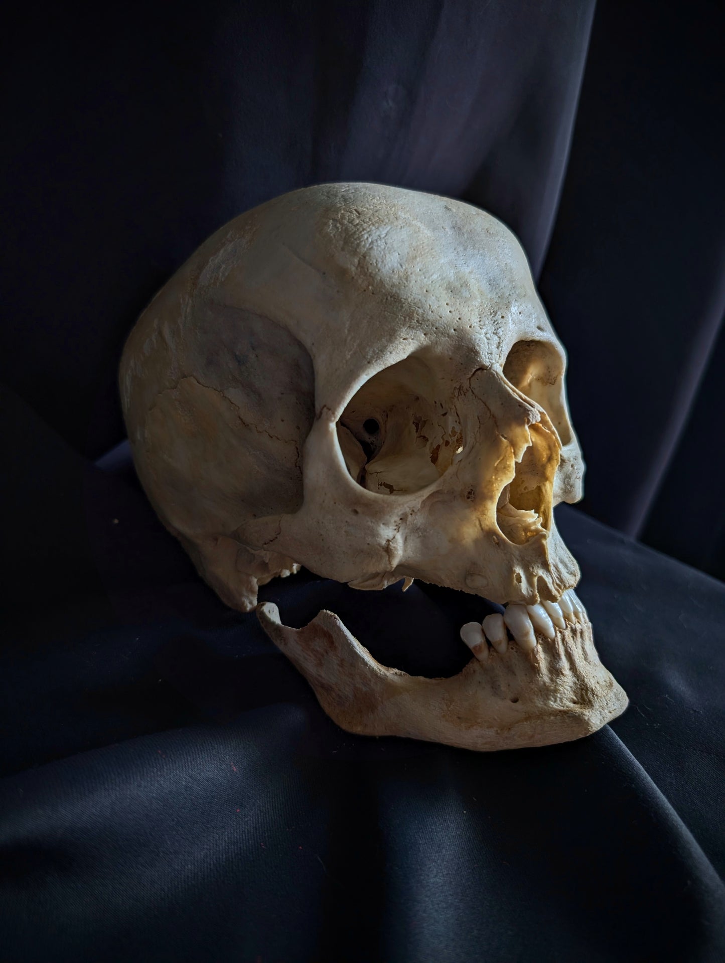 An antique German skull from the late 19th century