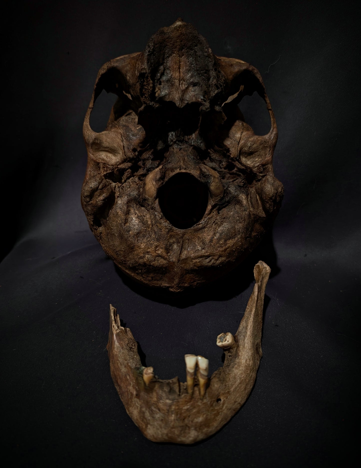 A beautiful antique skull from the 19th century with a dark patina (from a private collection in Italy)