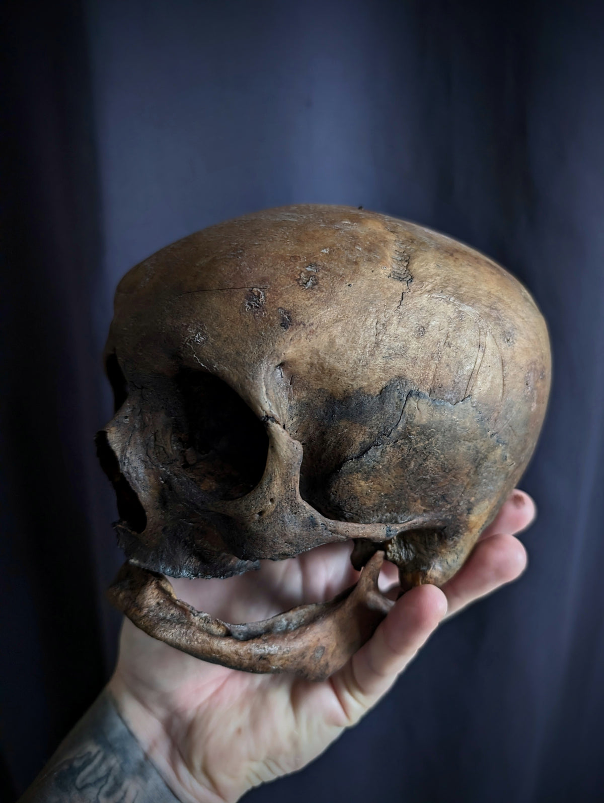 Antique Woman Skull with dark patina – Unusual Cranial Shape (Mid-19th Century, Italy)