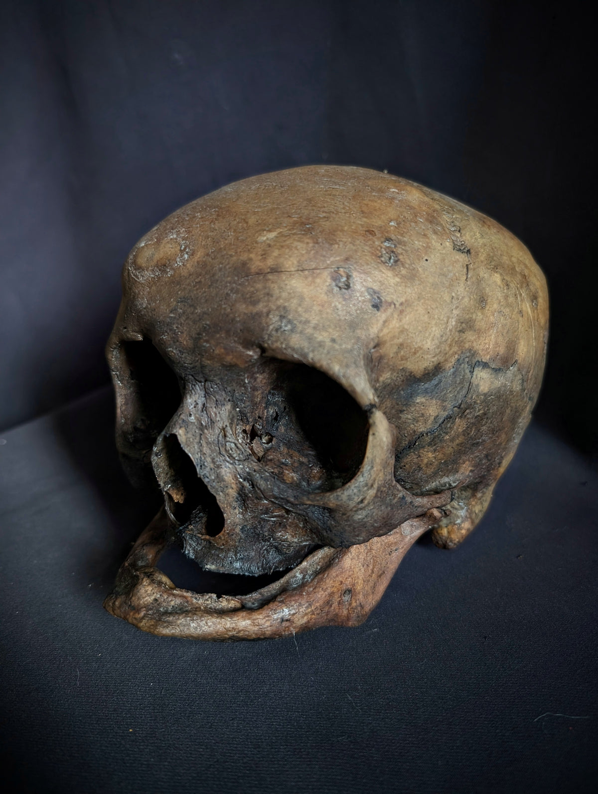 Antique Woman Skull with dark patina – Unusual Cranial Shape (Mid-19th Century, Italy)