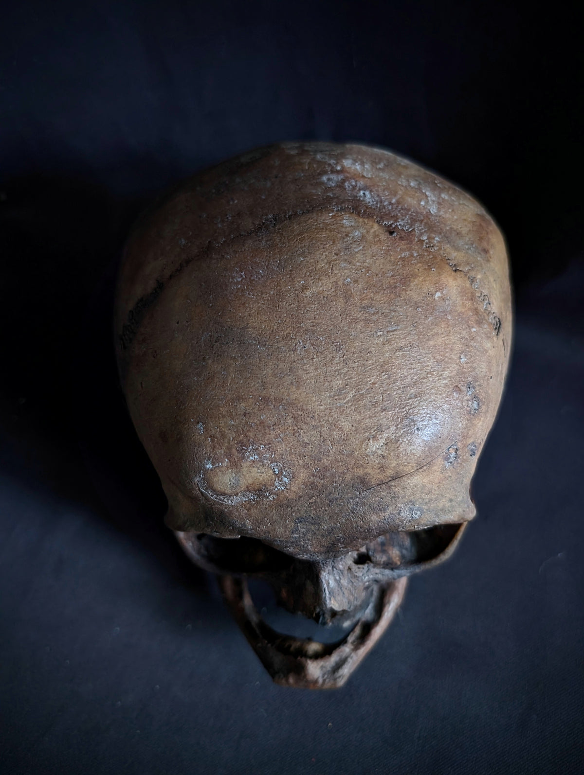 Antique Woman Skull with dark patina – Unusual Cranial Shape (Mid-19th Century, Italy)